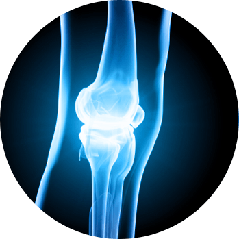 Outpatient Joint Replacement